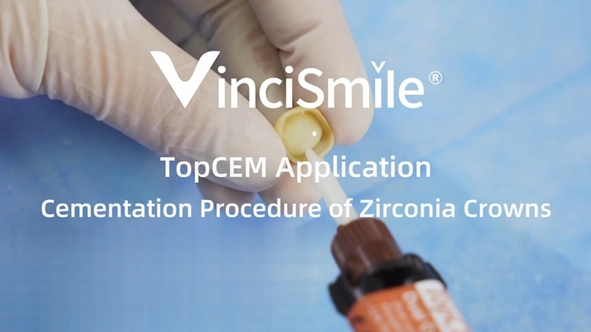 Vincismile topcem การฟื้นฟูทางอ้อม-การซีเมนต์ของมงกุฎเซอร์โคเนีย