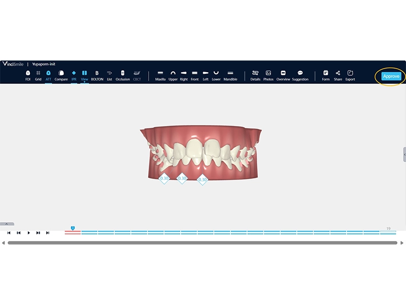 3.อนุมัติโครงการ3D